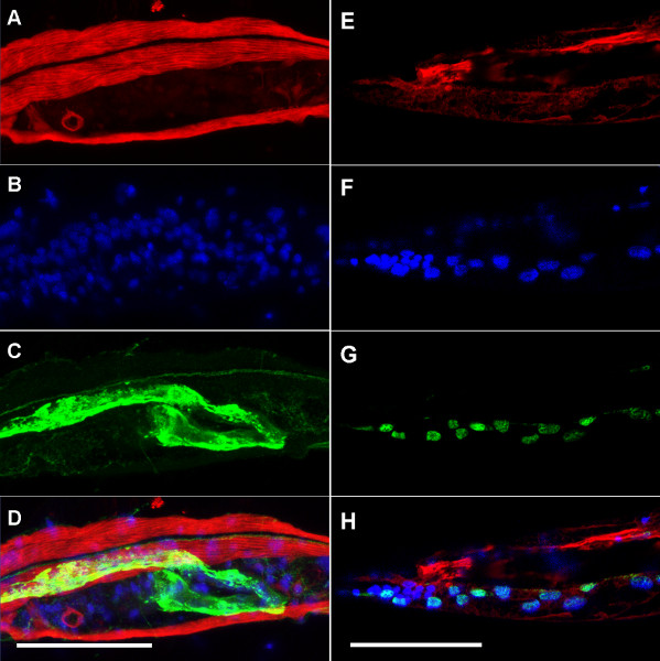figure-results-3 Fluorescence microscopy images of muscle fibers, highlighting cellular structures and protein expressions.