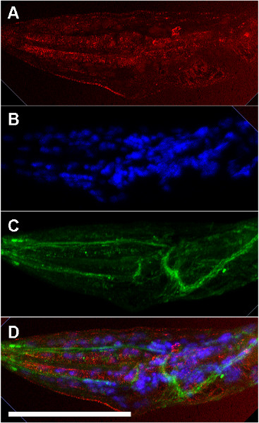 figure-results-4 Fluorescence microscopy images in red, blue, green channels; protein localization study; merged view.
