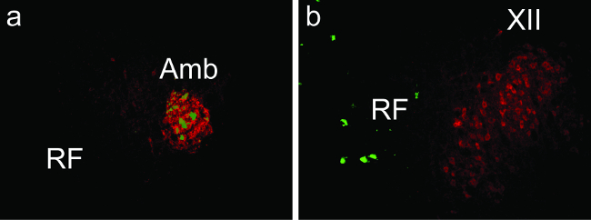 Fluorescent labeling microscopy, neural regions: Amb, RF; high-resolution imaging, cellular analysis.
