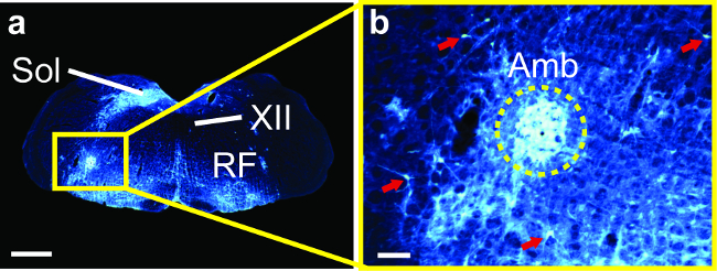 Neural tissue microscopy image highlighting Sol, XII, RF, and Amb regions for structural analysis.