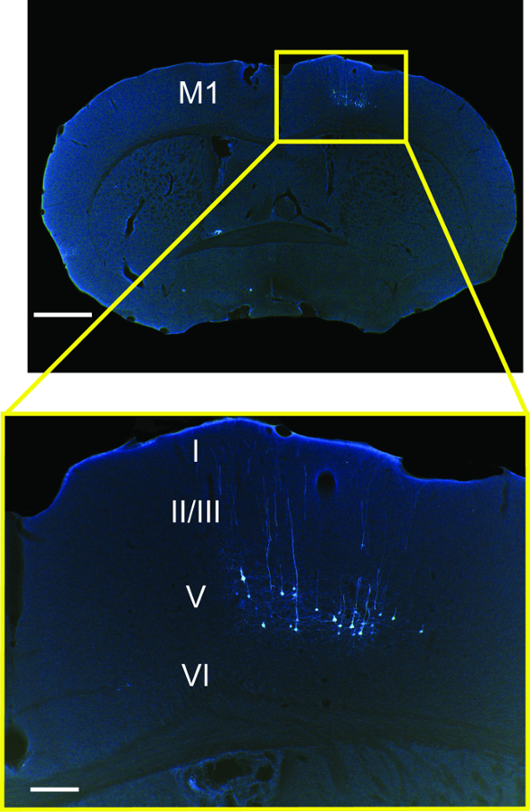 Mouse brain section diagram, labeled cortical layers I-VI, highlighting M1 area, fluorescent microscopy.