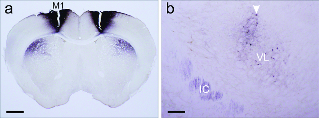 Brain slice histology, coronal section analysis, staining pattern, neural tissue examination, IC, VL.