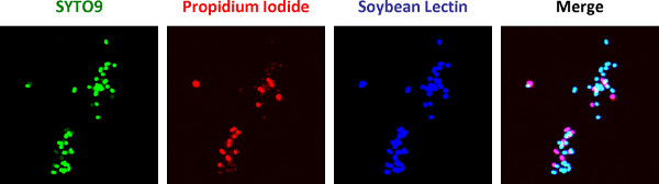 figure-results-1 Fluorescence microscopy diagram; SYTO9, Propidium Iodide, Soybean Lectin staining comparison and merge.