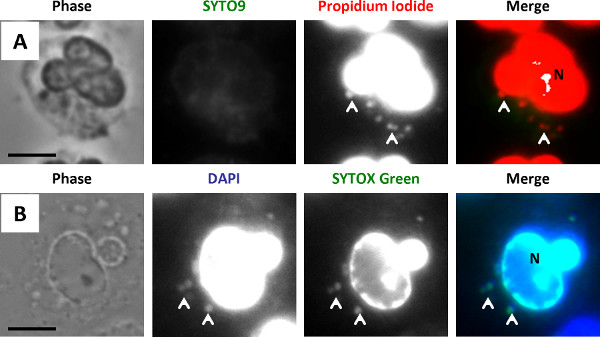 figure-results-3 Fluorescence microscopy of cells; SYTO9, DAPI, Propidium Iodide assays, merged overlay results.