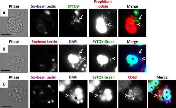 figure-results-4 Fluorescence microscopy of cell labeling with soybean lectin, SYTO9, DAPI, and propidium iodide.