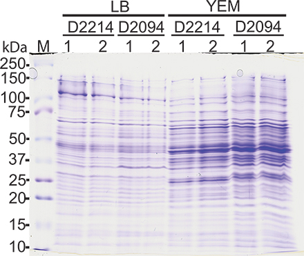 Video: Total Protein Extraction and 2-D Gel Electrophoresis Methods for ...