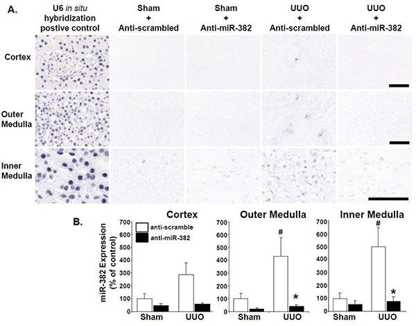 figure-results-3 In situ hybridization of miR-382 in kidney tissue; expression analysis in cortex, medulla; bar graph.