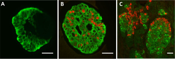 Fluorescence microscopy of cell structures; green and red markers in tissue samples; cellular analysis.
