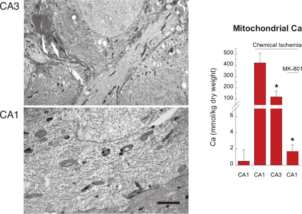 Measurement of Total Calcium in Neurons by Electron Probe X-ray ...