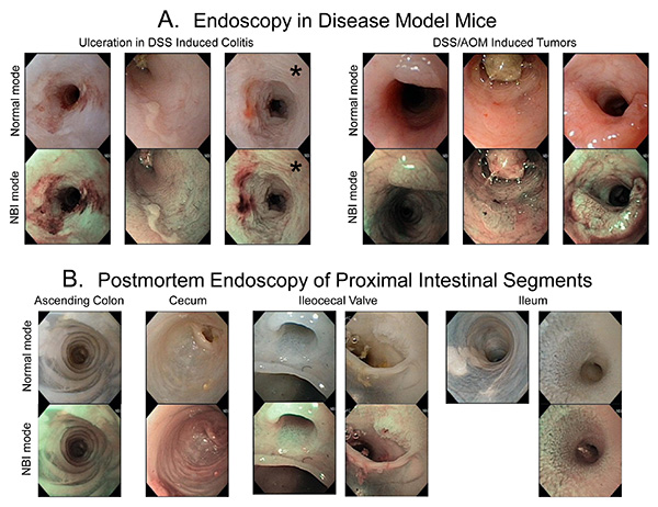 figure-results-6 Endoscopy images of disease model mice and postmortem intestinal segments; normal and NBI modes.