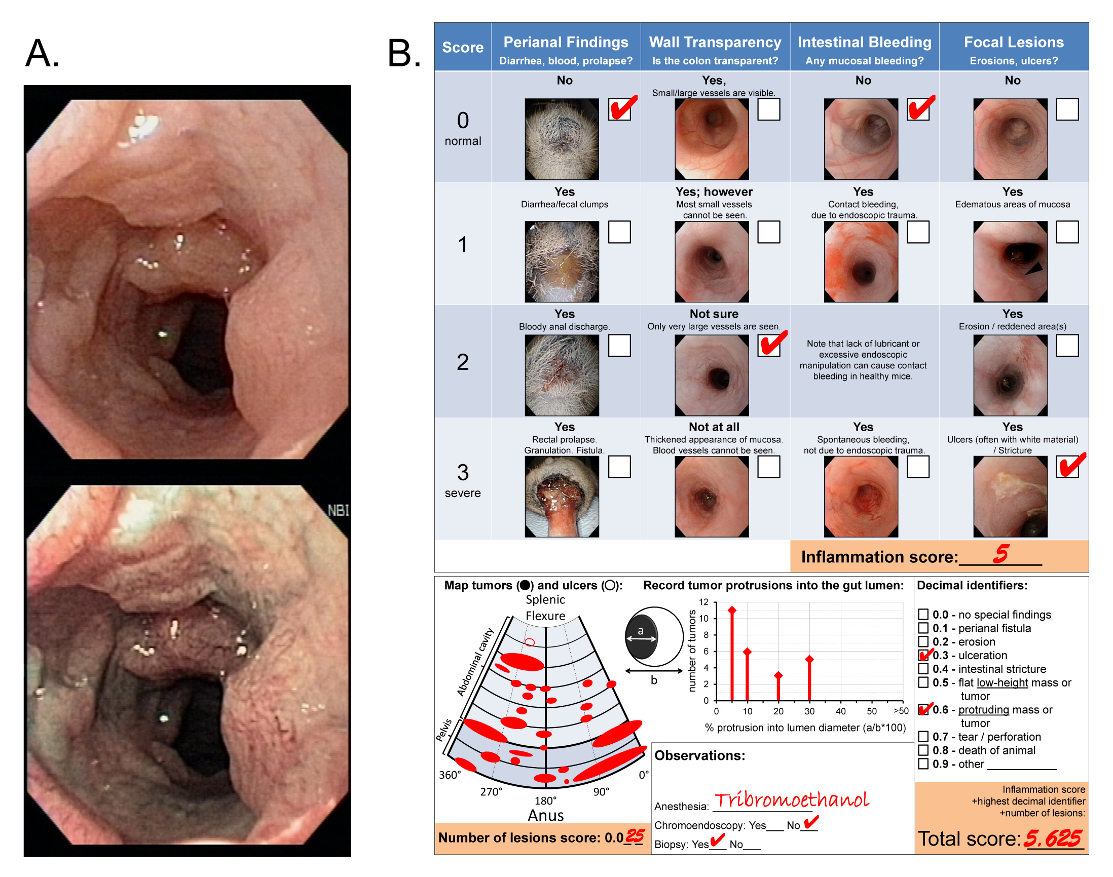 figure-results-10 Endoscopy images of colon with inflammation score chart, lesion mapping, and analysis details.