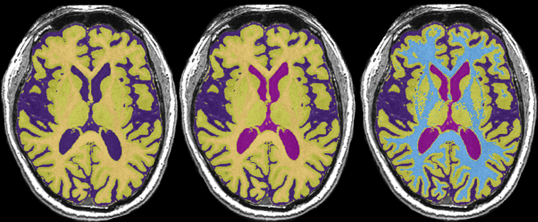 figure-results-6 Brain MRI segmentation results; neural tissue differentiation, anatomical structure visualization.