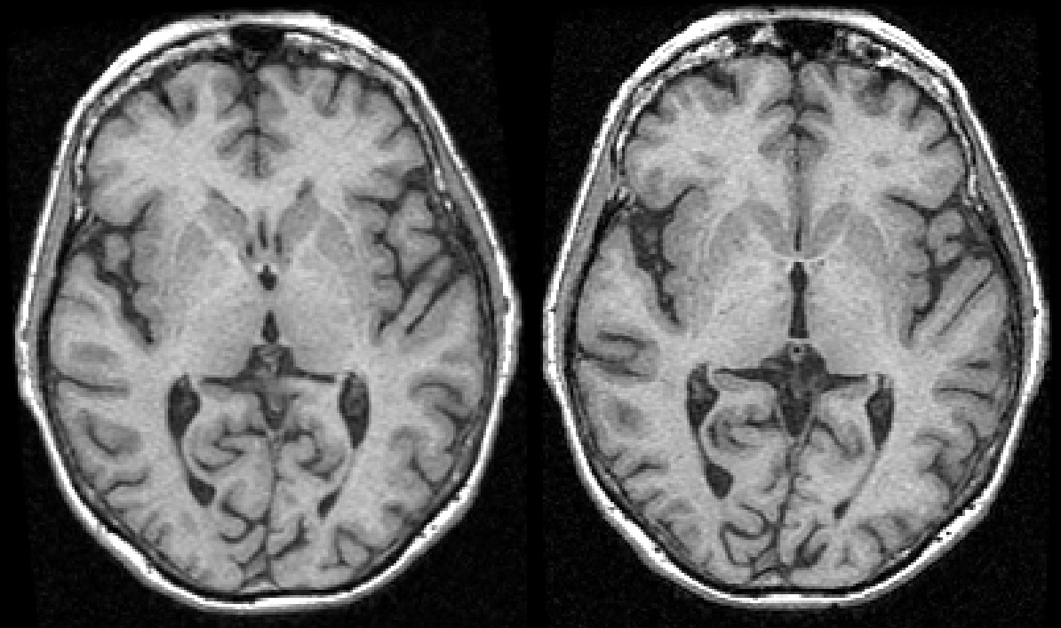 figure-results-8 Brain MRI scans; axial view; neuroimaging; medical analysis; compare; structural visualization