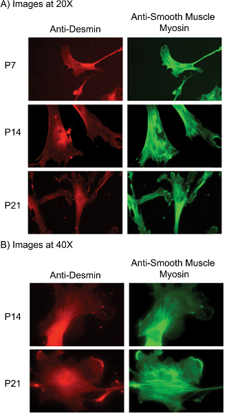 Isolation of Pulmonary Artery Smooth Muscle Cells from Neonatal Mice