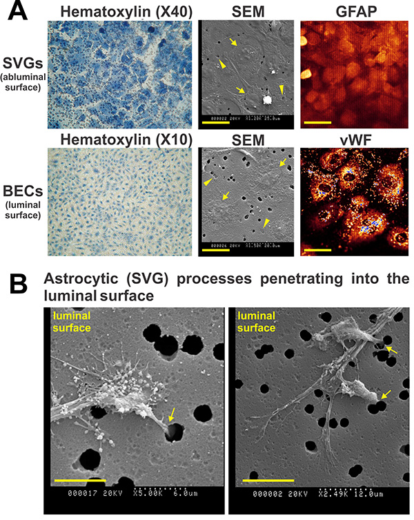 Hematoxylin, SEM, and fluorescence images of SVGs and BECs on luminal and abluminal surfaces.