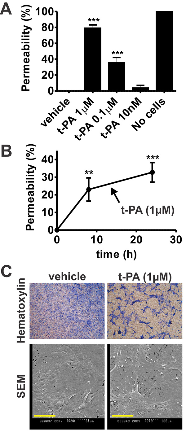 t-PA permeability assessment; bar chart, line graph, hematoxylin, and SEM images; experiment.