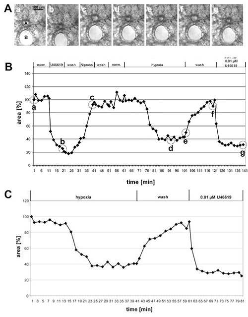 Electron microscopy and line graph showing cellular response to hypoxia and U46619 over time.