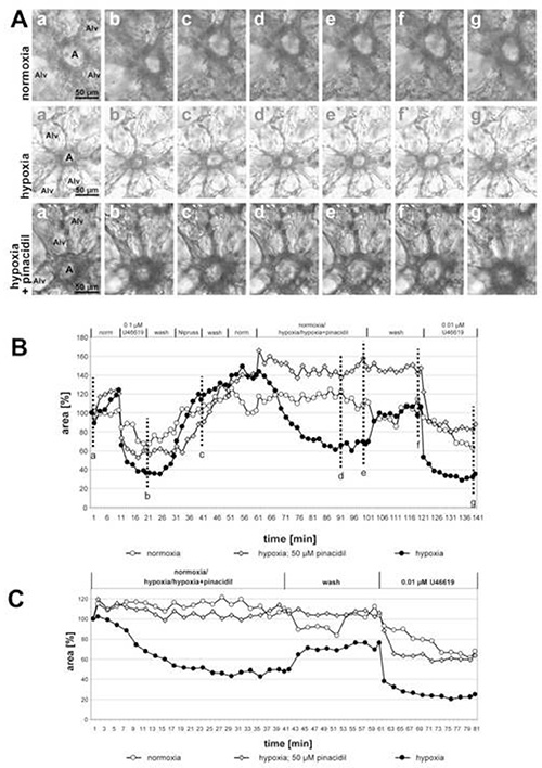 Cell morphology under normoxia/hypoxia; microscopy images, time-course analysis graphs (B,C).