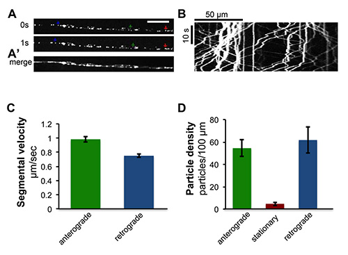Intracellular transport analysis: fluorescence microscopy, particle tracking, velocity and density graphs.