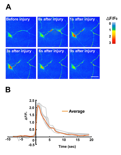Calcium imaging; ΔF/F₀; diagram of neuronal response over time; post-injury fluorescent change.