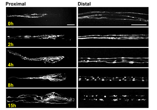 Time-lapse microscopy of nerve fiber progression, proximal and distal views, over 15 hours.