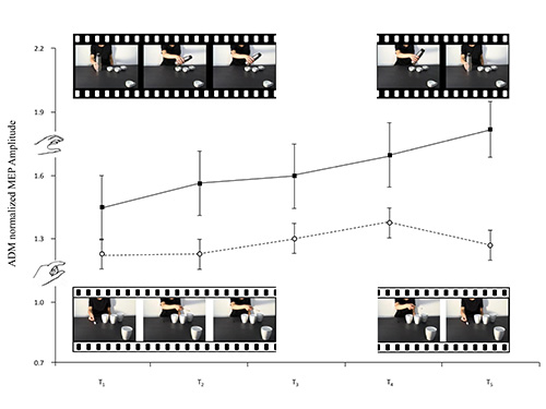 Muscle response graph with MEP amplitude over time; includes video sequences; neural study.