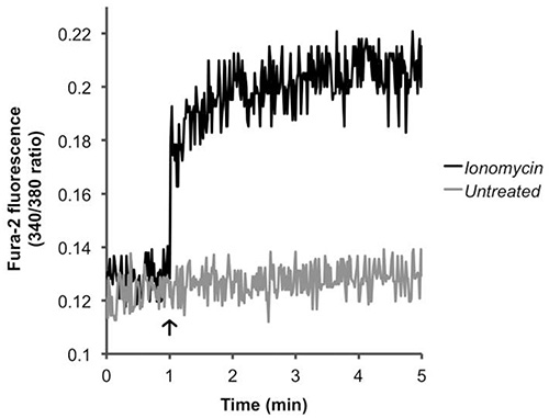 Fura-2 fluorescence ratio graph; ionomycin effect vs untreated over time; calcium signaling study.