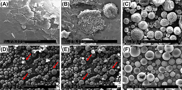 figure-results-4 SEM micrograph depicting particle morphology and aggregation. Powder microstructure analysis.