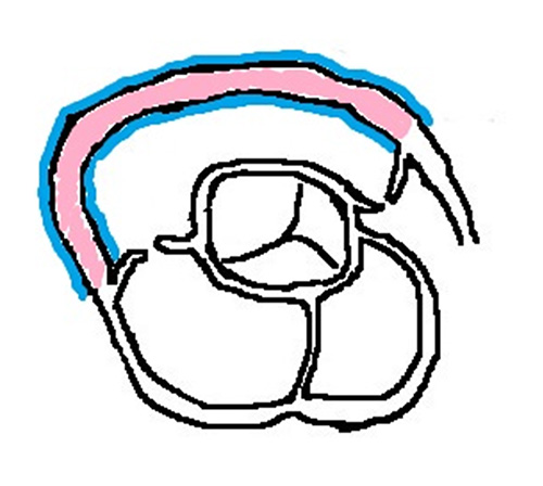 Assessment of Right Ventricular Structure and Function in Mouse Model ...