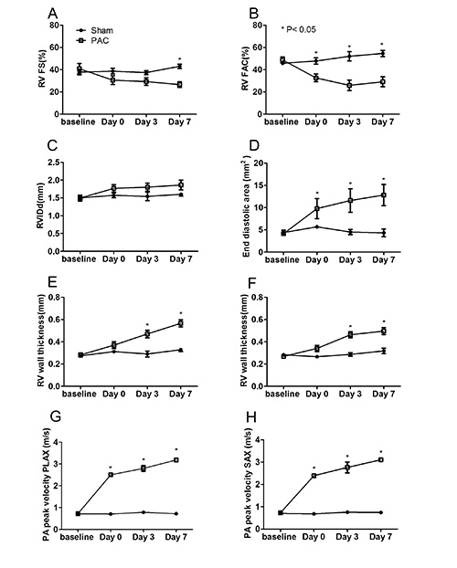 Assessment of Right Ventricular Structure and Function in Mouse Model ...