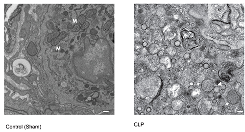 Electron microscopy showing mitochondria in control vs. CLP tissue, highlighting morphological changes.