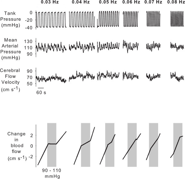 figure-results-5 Cerebral blood flow control graph; Tank pressure, MAP, flow velocity vs. frequency analysis.