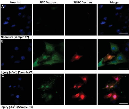 Fluorescence microscopy of cell injury showing Hoechst, FITC/TRITC Dextran; analysis of calcium effects.