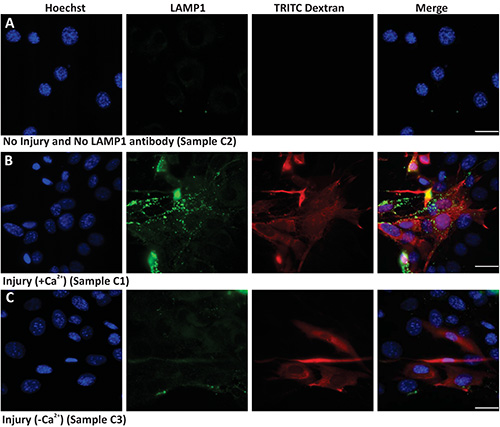 Cellular imaging of LAMP1 and TRITC Dextran in injury model; fluorescence microscopy result.