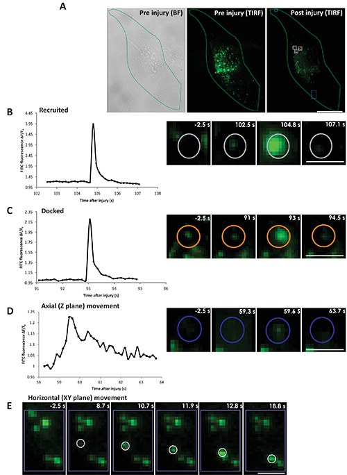 TIRF microscopy analysis showing protein recruitment, docking, and movement post-injury in cells.
