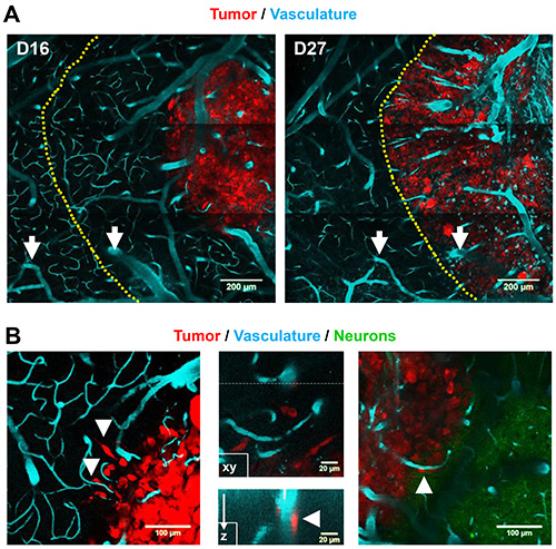 An Orthotopic Glioblastoma Mouse Model Maintaining Brain Parenchymal ...