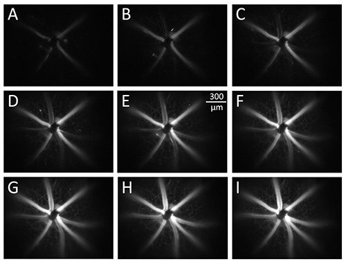 figure-results-2 Radial pattern fluorescence microscopy images; stages from initial to complete development.