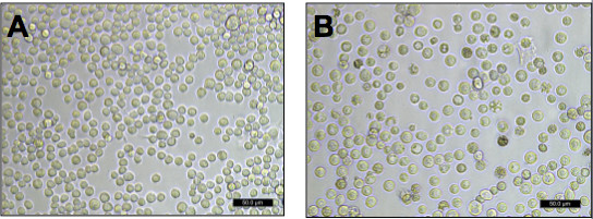 Blood cell analysis; microscope image; comparison of two samples; cellular morphology study.