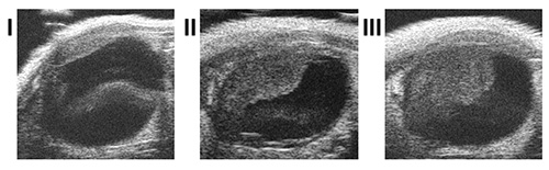 figure-results-4 Ultrasound imaging sequence, showing tissue structure in three stages; medical diagnostic analysis.