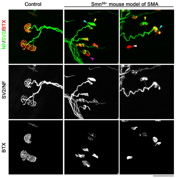 figure-results-3 Fluorescent microscopy of NF/SV2/BTX in control and Smn2B/- SMA mouse model, neuromuscular analysis.