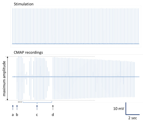 Stimulation and CMAP recordings, chart of neural response, electrophysiology analysis results.