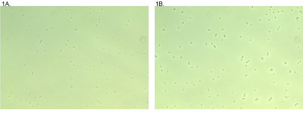 figure-results-1 Microscope image of bacterial growth; two stages, comparison of cell distribution, microscopy analysis.