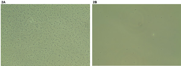 figure-results-2 Bacterial suspension microscope image comparison; high vs low concentration analysis.