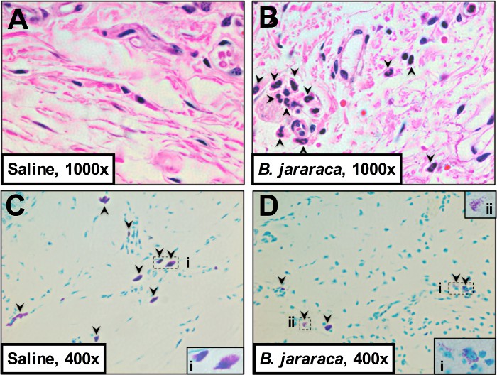 figure-results-2 Histopathology comparison, saline vs. B. jararaca venom effects, 1000x and 400x, microscopy study.