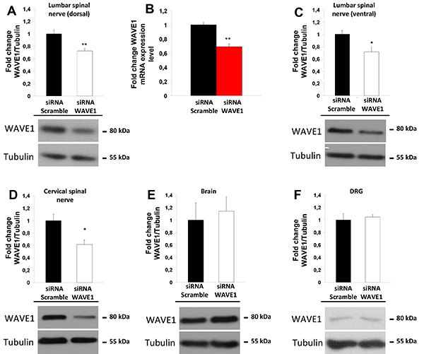 In Vivo SiRNA Transfection and Gene Knockdown in Spinal Cord via Rapid ...