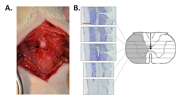Surgical procedure and spinal cord cross-section analysis diagram, nerve dissection, histological comparison.