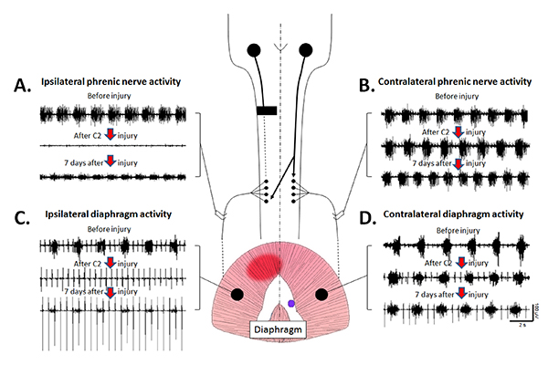 Phrenic nerve and diaphragm activity diagram, pre/post-C2 injury analysis, showing nerve signals.