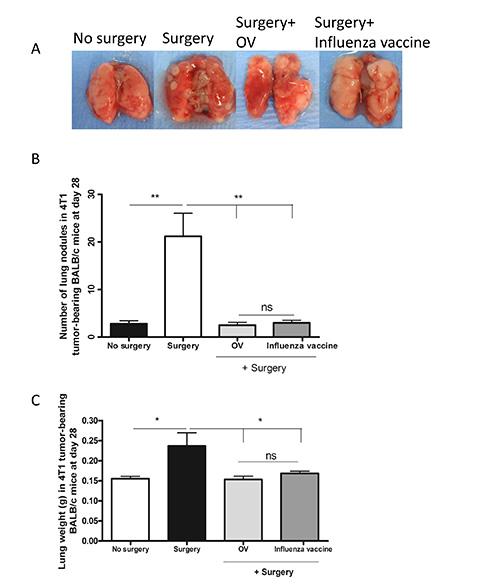 figure-results-1 Lung surgery tumor inhibition study, mouse tissue images, nodule and weight analysis, bar chart.