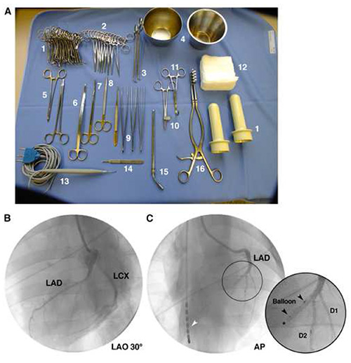figure-results-1 Surgical tools and angioplasty procedure; includes x-ray images of coronary artery intervention.