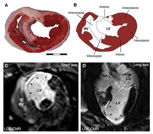 figure-results-2 Cardiac MRI showing heart ventricle structure; labeled diagram; short, long axis views.
